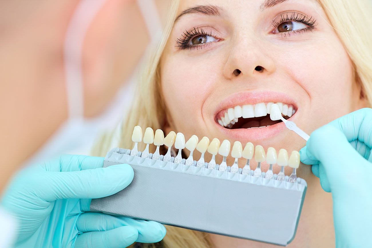 What Are the Long-Term Benefits of Veneers in Cosmetic Dentistry?