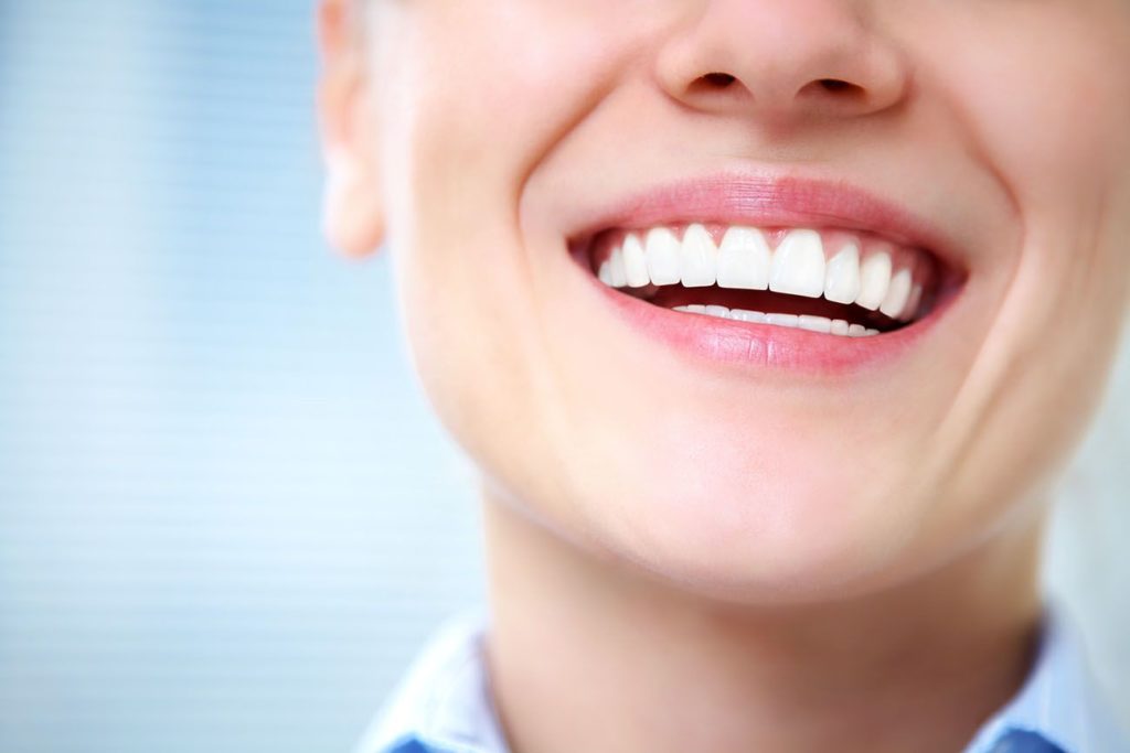 professional teeth whitening in Towson Maryland
