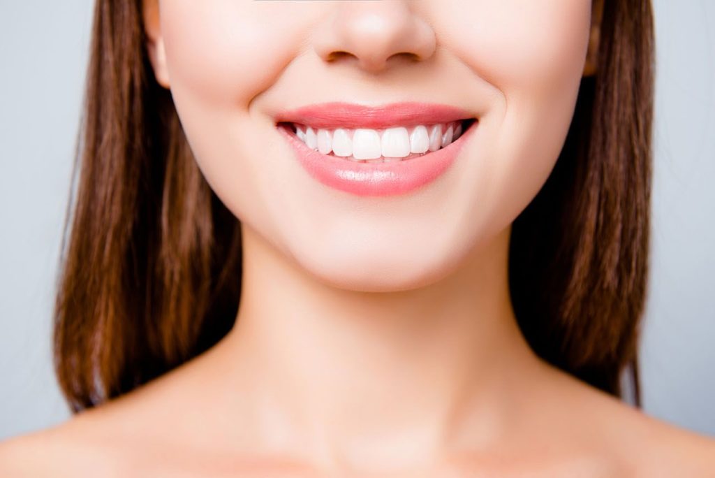 smile enhancement treatment with teeth bonding